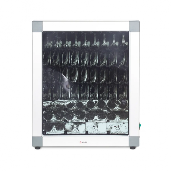 Негатоскоп общего назначения Армед 1-кадровый, 1726301