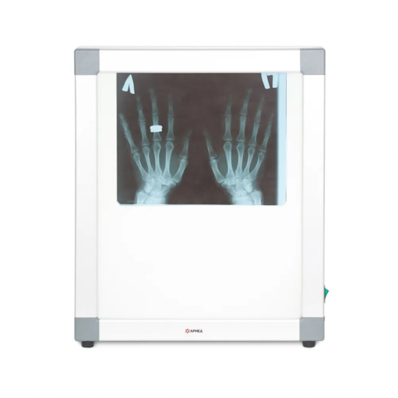 Негатоскоп общего назначения Армед 1-кадровый, 1726301