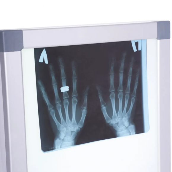 Негатоскоп общего назначения Армед 1-кадровый, 1726301