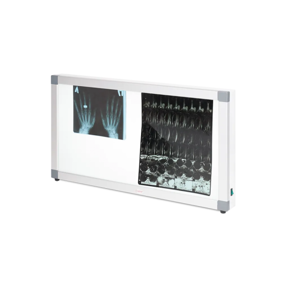 Негатоскоп общего назначения Армед 2-кадровый, 1726401